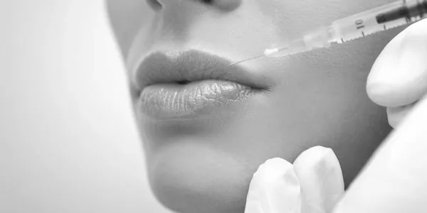 Lip Filler — 1ml