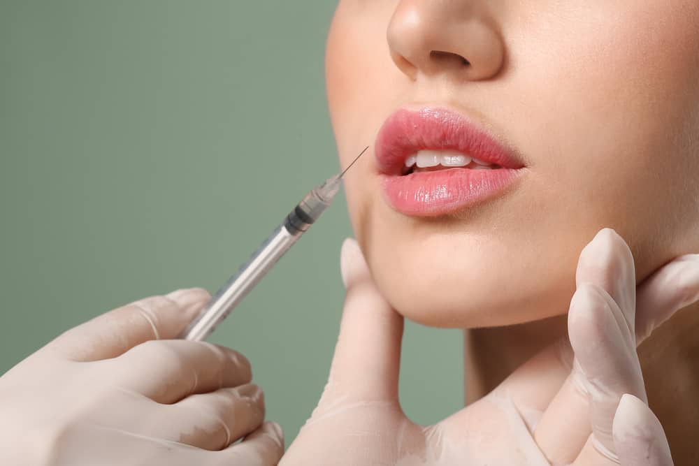 Cheek Filler — 1ml